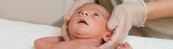 Prevención y tratamiento de plagiocefalia en bebés