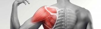 Tendinitis de hombro qué es, causas y tratamiento en FisioClincs Madrid 