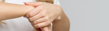 Tratamiento osteopático para el síndrome del túnel carpiano - FisioClinics Madrid