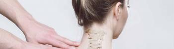 Hernia Discal Cervical: Abordaje mediante la Fisioterapia para la Radiculopatía Cervical - FisioClinics Madrid Hernia Discal Cervical: Abordaje mediante la Fisioterapia para la Radiculopatía Cervical - FisioClinics Madrid
