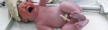 ¿Qué es el test de Apgar? y su función en el recién nacido