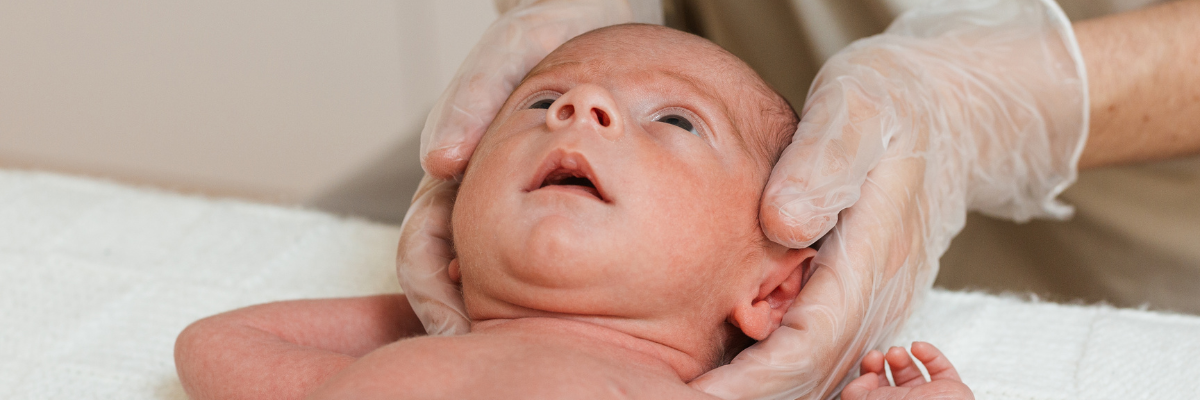 Prevención y tratamiento de plagiocefalia en bebés