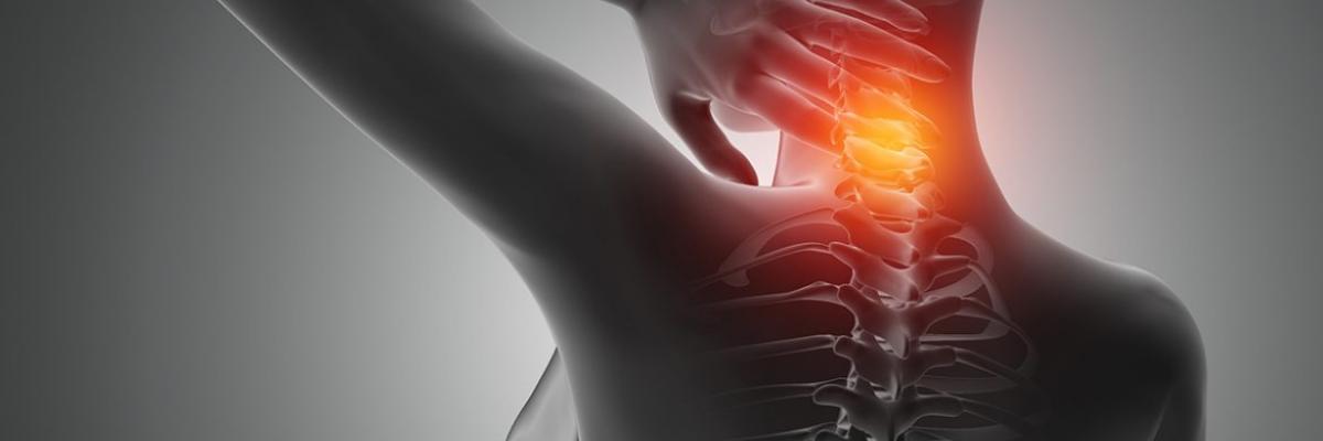 Cervicalgia y el abordaje de la Fisioterapia