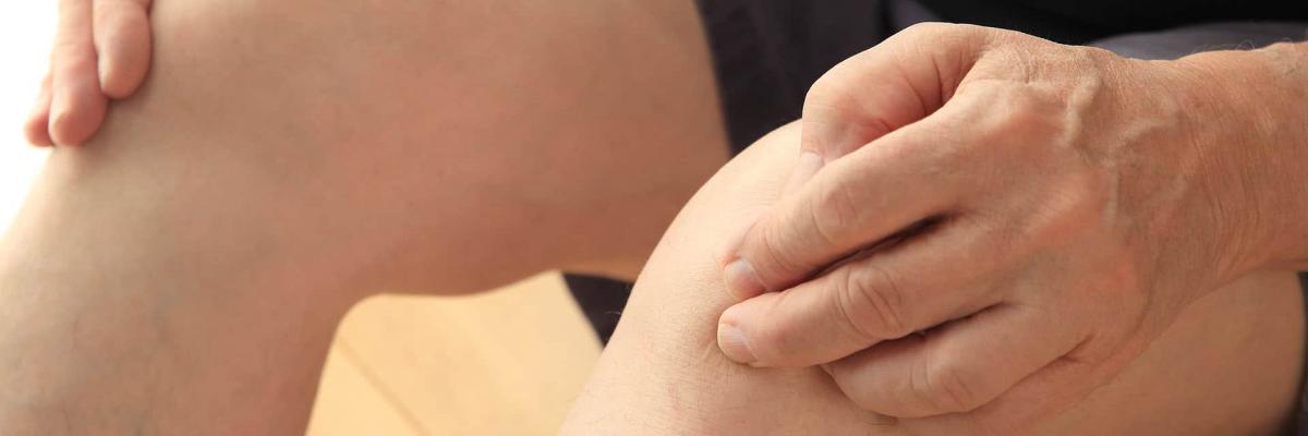 ¿Qué es la Tendinitis Rotuliana o Rodilla del Saltador? - FisioClinics Madrid